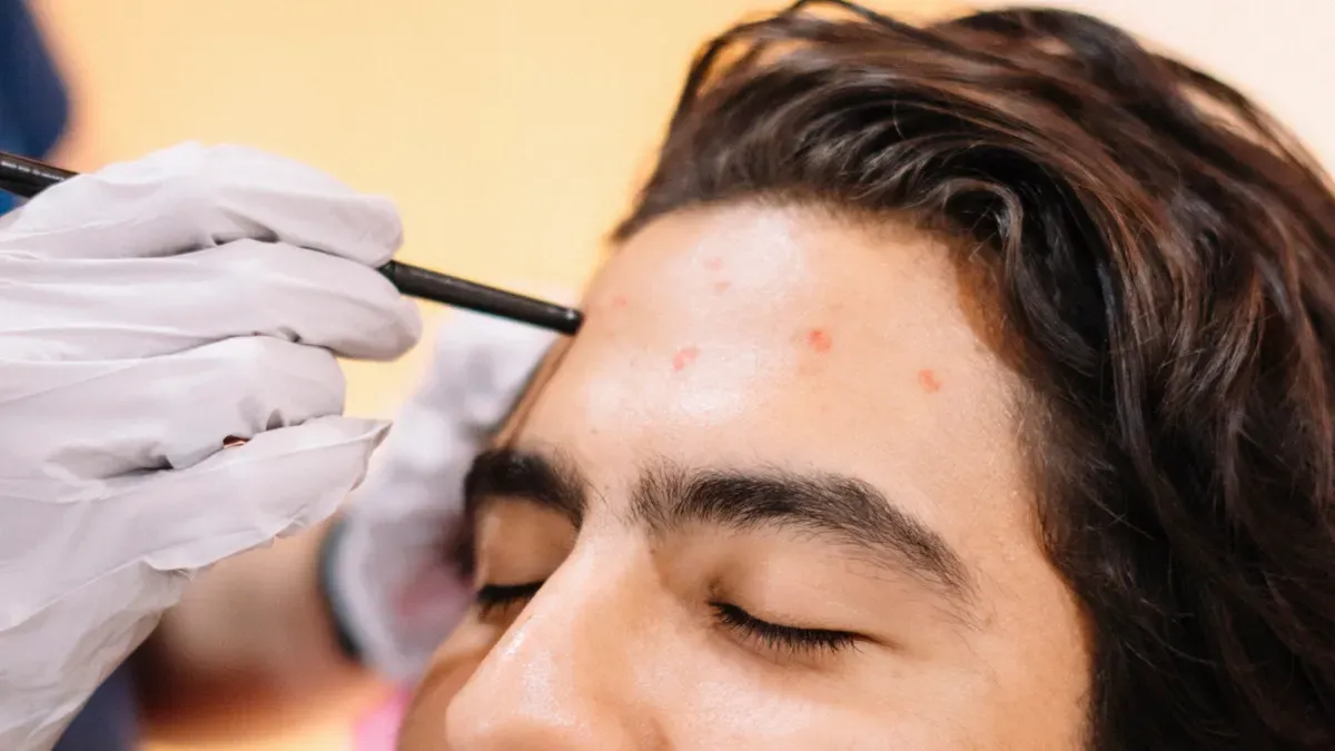 &Agrave; quoi sert principalement un stylo de greffe de cheveux ?